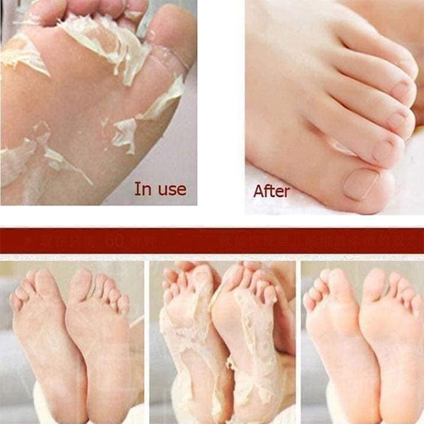 Túi ủ bông da chết bàn chân Mino 